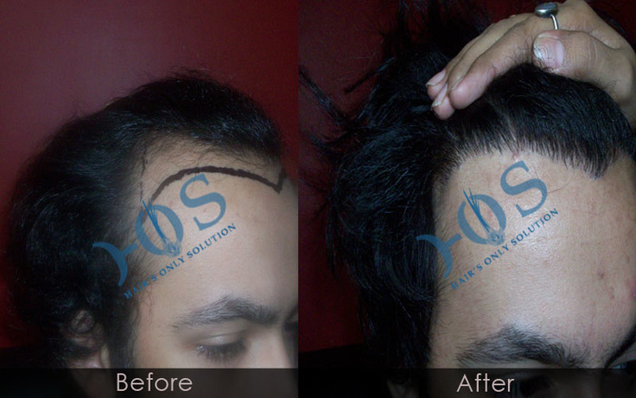  New Album of Hos Hair Clinic A-757, Tulsi Marg, Sec 19 - Photo 8 of 9