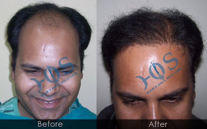  New Album of Hos Hair Clinic A-757, Tulsi Marg, Sec 19 - Photo 9 of 9
