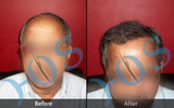  Hos Hair Clinic A-757, Tulsi Marg, Sec 19 