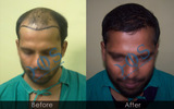  Hos Hair Clinic A-757, Tulsi Marg, Sec 19 