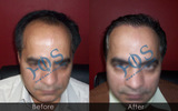  Hos Hair Clinic A-757, Tulsi Marg, Sec 19 
