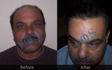  Hos Hair Clinic A-757, Tulsi Marg, Sec 19 