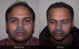  Hos Hair Clinic A-757, Tulsi Marg, Sec 19 