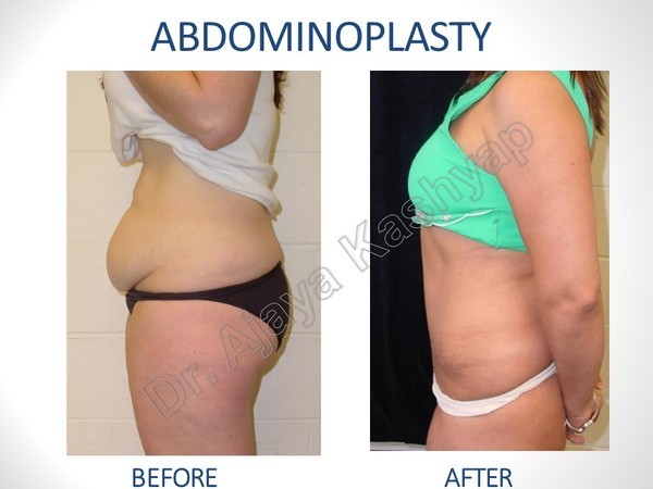  Pricelists of Best Cosmetic & Plastic Surgeon in Delhi, Dr. AJaya Kashyap 13A, Palam Marg, Vasant Vihar - Photo 1 of 1