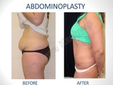 Menus & Prices, Best Cosmetic & Plastic Surgeon in Delhi, Dr. AJaya Kashyap, New Delhi