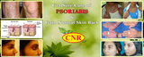 drcnrajadurai | Psoriasis Treatment in Chennai, chennai