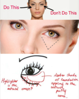 Eyebagencyclopedia - Eybag removal in Singapore, Singapore