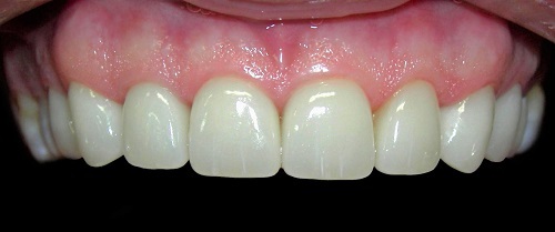  Larchmont Dental Associates of Larchmont Dental Associates 581 North Larchmont Boulevard - Photo 2 of 3