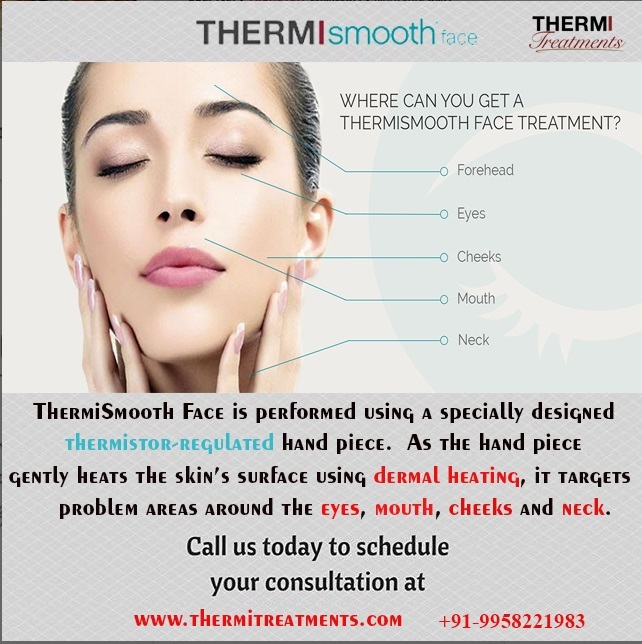 Thermismooth-Face treatment for Forehead, Eye, cheek, Mouth, Neck ThermiRF of Thermi Treatment 13A PALAM MARG, VASANT VIHAR - Photo 4 of 6 Thermismooth-Face treatment for Forehead, Eye, cheek, Mouth, Neck ThermiRF of Thermi Treatment 13A PALAM MARG, VASANT VIHAR - Photo 4 of 6