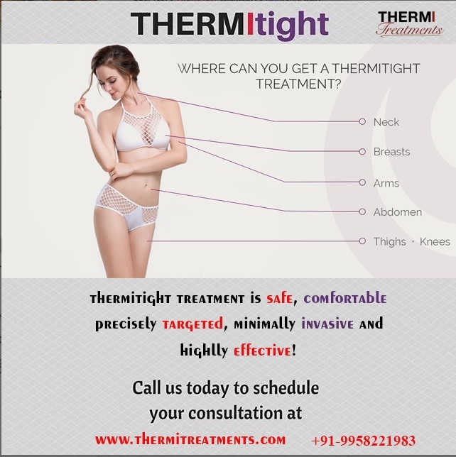 Thermitight Treatment for Neck, Breast, Arm, Abdomen, Thigh, Knee ThermiRF of Thermi Treatment 13A PALAM MARG, VASANT VIHAR - Photo 5 of 6 Thermitight Treatment for Neck, Breast, Arm, Abdomen, Thigh, Knee ThermiRF of Thermi Treatment 13A PALAM MARG, VASANT VIHAR - Photo 5 of 6