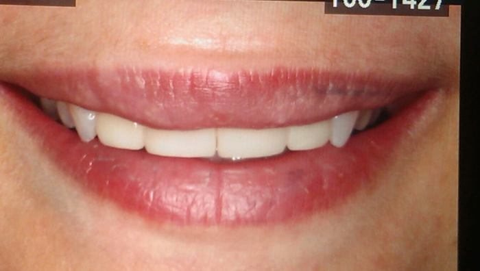 After Teeth Whitening Dearborn and Woodhaven MI Profile Photos of All Brite Dental 22190 Garrison St Suite 205 - Photo 10 of 17