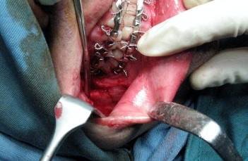  Profile Photos of 32PEARLS IMPLANT & ORTHODONTIC DENTAL HOSPITAL SANTOKHGARH MDR 39;Near  New Bus Stand - Photo 6 of 7
