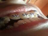  32PEARLS IMPLANT & ORTHODONTIC DENTAL HOSPITAL SANTOKHGARH MDR 39;Near  New Bus Stand 