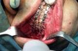 32PEARLS IMPLANT & ORTHODONTIC DENTAL HOSPITAL SANTOKHGARH, Santokhgarh