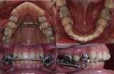 32PEARLS IMPLANT & ORTHODONTIC DENTAL HOSPITAL SANTOKHGARH, Santokhgarh