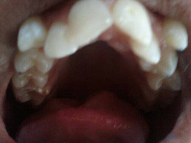  Pricelists of 32PEARLS IMPLANT & ORTHODONTIC DENTAL HOSPITAL SANTOKHGARH MDR 39;Near  New Bus Stand - Photo 3 of 5