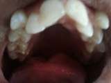 Menus & Prices, 32PEARLS IMPLANT & ORTHODONTIC DENTAL HOSPITAL SANTOKHGARH, Santokhgarh