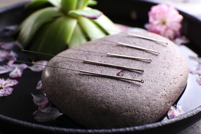  Profile Photos of Acupuncture DN Clinic 1 Bedford Mews - Photo 1 of 1