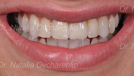 Dental Implants After Frisco, TX Profile Photos of West Frisco Dental And Implants 10050 Legacy Dr. Suite 600 - Photo 1 of 10