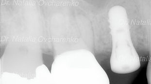 dentist in frisco tx - westfriscodental.com Profile Photos of West Frisco Dental And Implants 10050 Legacy Dr. Suite 600 - Photo 3 of 10