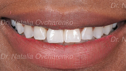 frisco tx dentist - westfriscodental.com Profile Photos of West Frisco Dental And Implants 10050 Legacy Dr. Suite 600 - Photo 7 of 10
