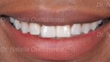 frisco tx dentist - westfriscodental.com, West Frisco Dental And Implants, Frisco