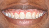 west frisco dentist - westfriscodental.com, West Frisco Dental And Implants, Frisco