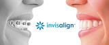 Invisalign Denver CO, Accent Dental, Denver