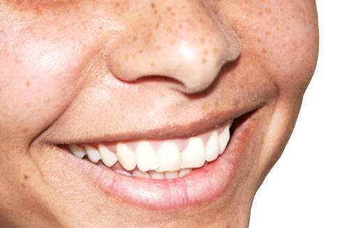 Implant Dentist San Antonio TX Profile Photos of Cosmetic Dental Associates 5837 Babcock Rd - Photo 5 of 6