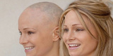 Meraki Hair Loss Clinic - Hair Loss Treatment Brisbane, Underwood