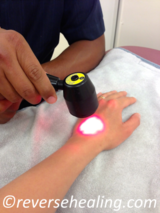 Laser Reverse Healing 69 Rosemary Avenue 