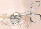  Amica Surgical Rang Pura 