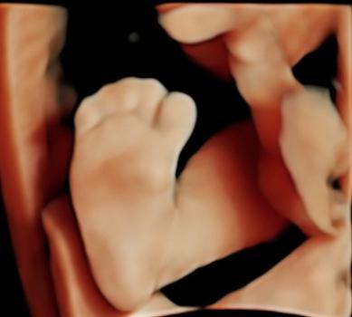  Profile Photos of Prenatal Universe Ultrasound 4301 S Pine St #30-05 - Photo 2 of 4