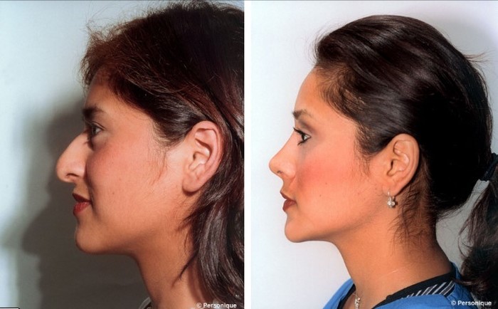  New Album of Personique Plastic Surgery Center 630 West 34th Street - Photo 2 of 3