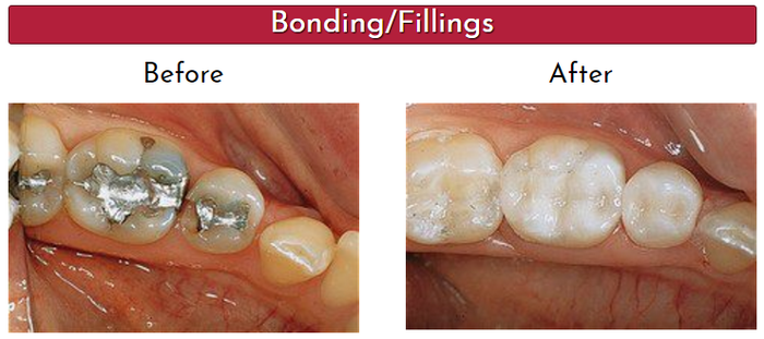  Robert Miller DDS of Robert Miller DDS 113 E Schaumburg Road, - Photo 3 of 8