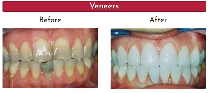  Robert Miller DDS of Robert Miller DDS 113 E Schaumburg Road, - Photo 2 of 8
