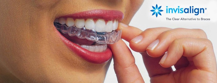 Crescent Family Dental<br />
522 N Magnolia Ave, Anaheim CA 92801<br />
(714) 515-3138<br />
www.CrescentFamilyDental.com Crescent Family Dental of Crescent Family Dental 522 N Magnolia Ave. - Photo 9 of 9