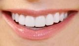Portage Park Dentist, Chicago