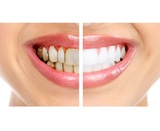 Portage Park Dentist, Chicago