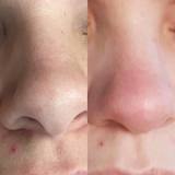 Atlanta Face & Body, Atlanta