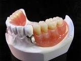 Denture Haus, Aspley