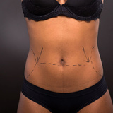 Eye Plastic Surgery Associates, Dallas