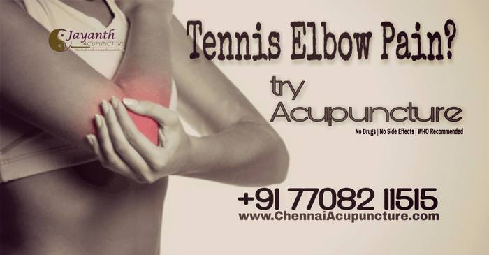 Acupuncture Treatment for Tennis elbow pain in Chennai Acupuncture Treatment Near Me of Chennai Jayanth Acupuncture Clinic # 33/18, 1st Floor, School Street, Next to Mahindra First Choice - Photo 21 of 27 Acupuncture Treatment for Tennis elbow pain in Chennai Acupuncture Treatment Near Me of Chennai Jayanth Acupuncture Clinic # 33/18, 1st Floor, School Street, Next to Mahindra First Choice - Photo 21 of 27