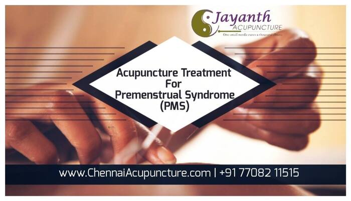Acupuncture Treatment for Premenstrual Syndrome (PMS) Acupuncture Treatment Near Me of Chennai Jayanth Acupuncture Clinic # 33/18, 1st Floor, School Street, Next to Mahindra First Choice - Photo 8 of 27 Acupuncture Treatment for Premenstrual Syndrome (PMS) Acupuncture Treatment Near Me of Chennai Jayanth Acupuncture Clinic # 33/18, 1st Floor, School Street, Next to Mahindra First Choice - Photo 8 of 27