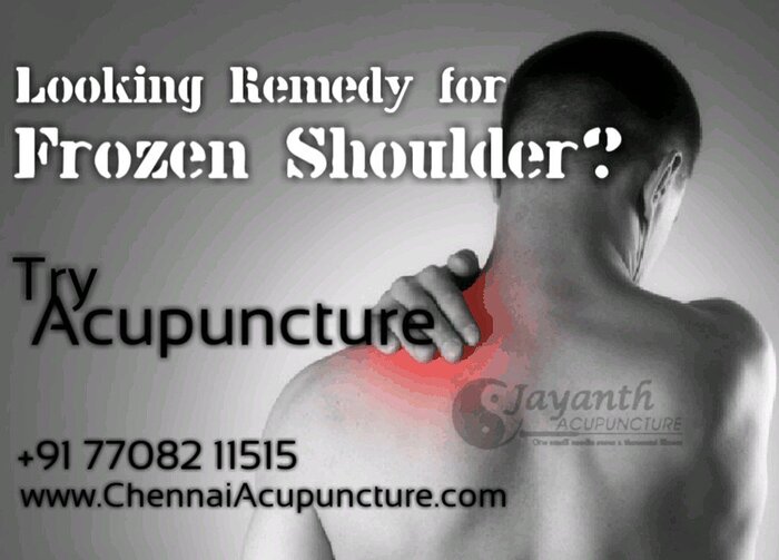 ACupuncture TReatment For Frozen Shoulder in Chennai Acupuncture Treatment Near Me of Chennai Jayanth Acupuncture Clinic # 33/18, 1st Floor, School Street, Next to Mahindra First Choice - Photo 5 of 27