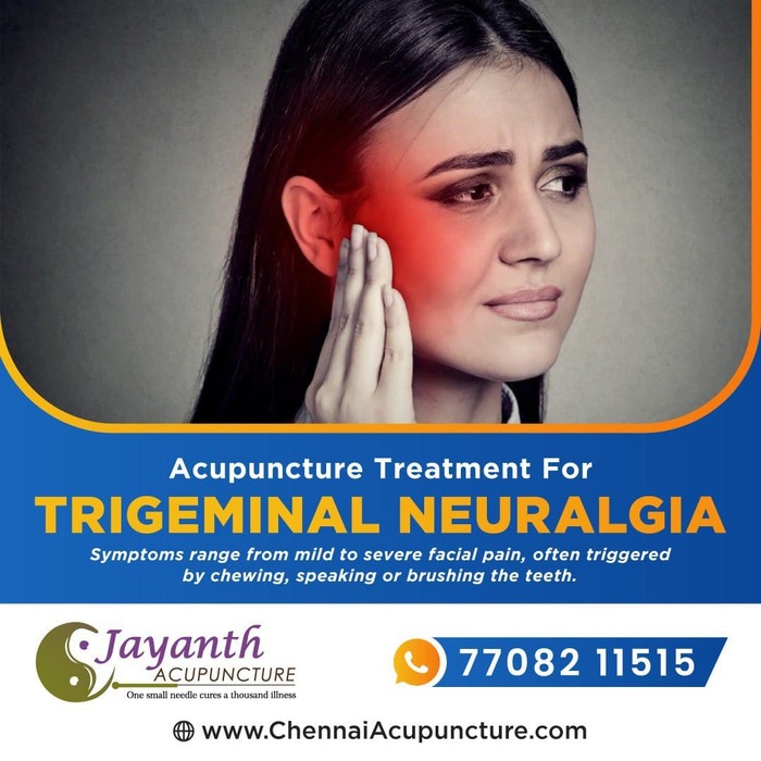 ACupuncture Treatment For Trigeminal Neuralgia in Chennai Acupuncture Treatment Near Me of Chennai Jayanth Acupuncture Clinic # 33/18, 1st Floor, School Street, Next to Mahindra First Choice - Photo 4 of 27 ACupuncture Treatment For Trigeminal Neuralgia in Chennai Acupuncture Treatment Near Me of Chennai Jayanth Acupuncture Clinic # 33/18, 1st Floor, School Street, Next to Mahindra First Choice - Photo 4 of 27