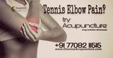 Acupuncture Treatment for Tennis elbow pain in Chennai Chennai Jayanth Acupuncture Clinic # 33/18, 1st Floor, School Street, Next to Mahindra First Choice 