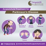 Acupuncture treatment for parkinson's disease in chennai Chennai Jayanth Acupuncture Clinic # 33/18, 1st Floor, School Street, Next to Mahindra First Choice 