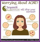 Acupuncture Treatment for Acne-Pimples Chennai Jayanth Acupuncture Clinic # 33/18, 1st Floor, School Street, Next to Mahindra First Choice 