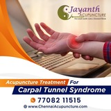 Acupuncture Treatment For Carpal Tunnel Syndrome in Chennai Chennai Jayanth Acupuncture Clinic # 33/18, 1st Floor, School Street, Next to Mahindra First Choice 